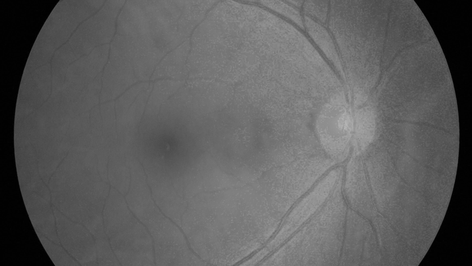 Ophthalmology